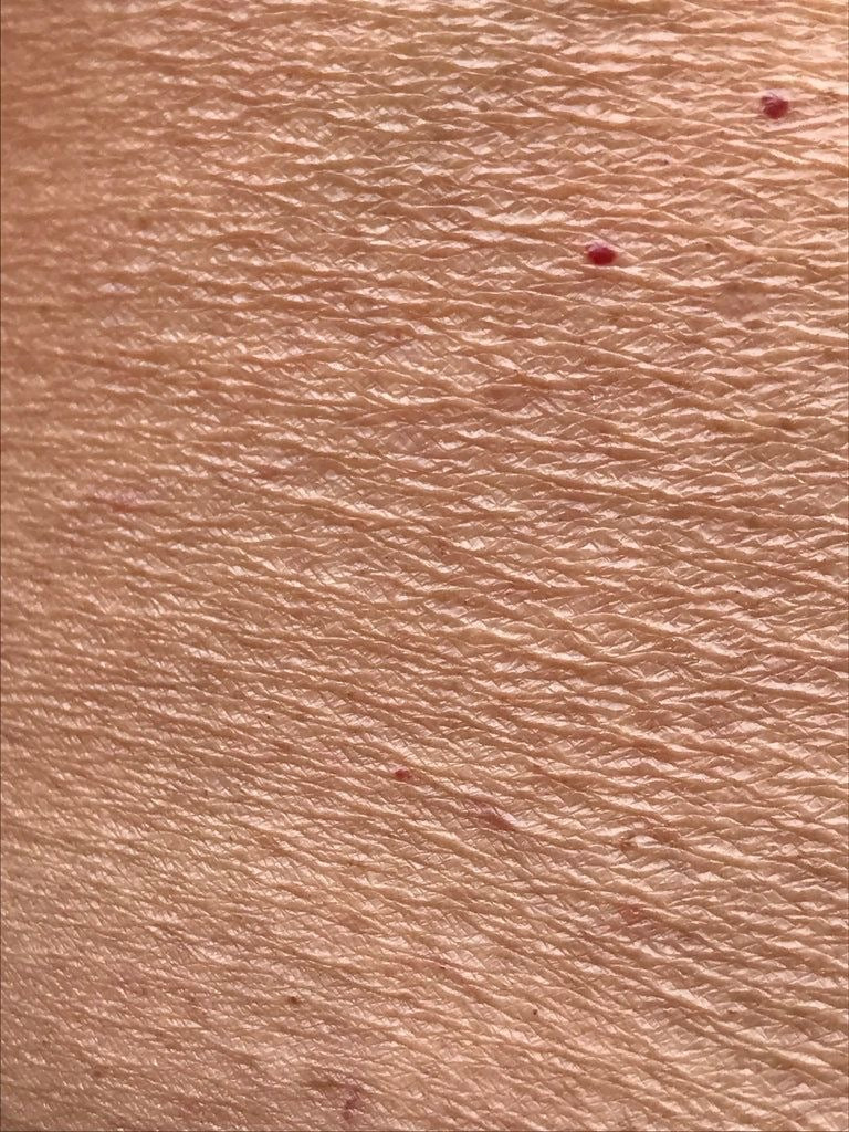 Dry & Dehydrated