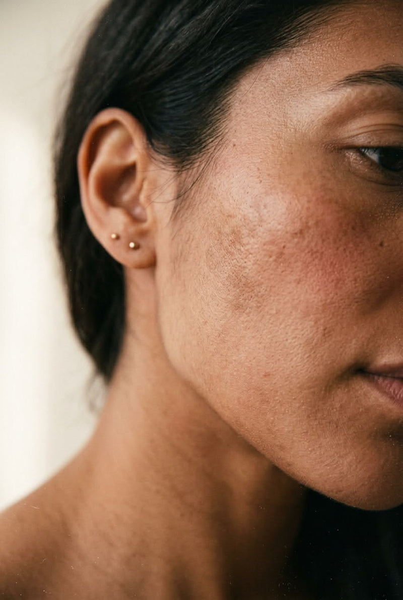 Pigmentation & Dark Spots
