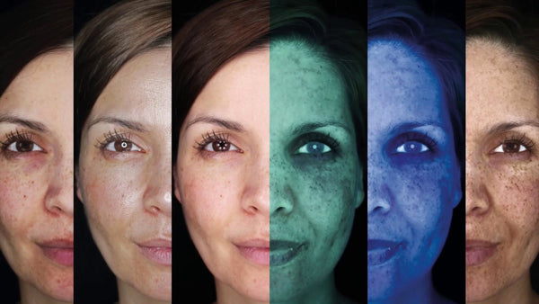 Skin Consultation & Analysis