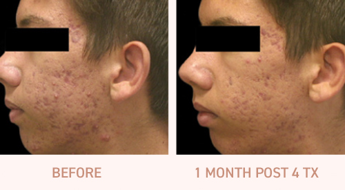 1-vivace-before-after