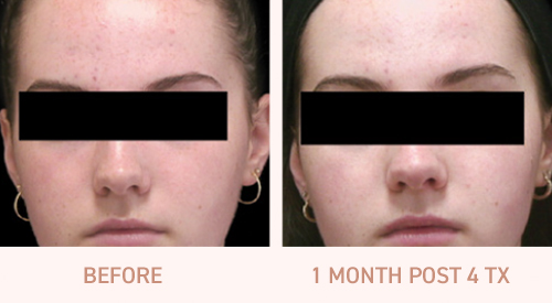 2-vivace-before-after