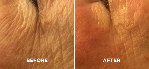 before-and-after-5